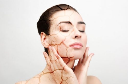 Tips Merawat kemudian Mengatasi Kulit Kering